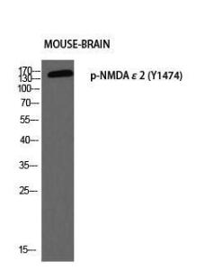 Western blot analysis of mouse BRAIN using Anti-NMDAR2B (phospho Tyr1474) Antibody