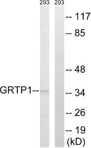 Western blot analysis of lysates from 293 cells using Anti-GRTP1 Antibody The right hand lane represents a negative control, where the antibody is blocked by the immunising peptide