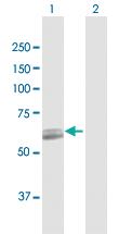 Anti-PCCB Rabbit Polyclonal Antibody