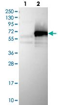 Anti-ZC3H15 Rabbit Polyclonal Antibody