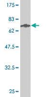 Anti-STEAP1 Mouse Monoclonal Antibody [clone: 4F6-1F3]