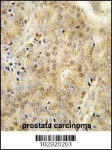 Anti-EZH1 Rabbit Polyclonal Antibody (HRP (Horseradish Peroxidase))