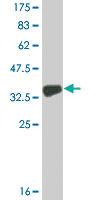 Anti-COL9A3 Mouse Monoclonal Antibody [clone: 2B5]