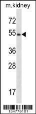 Anti-FRK Rabbit Polyclonal Antibody (Biotin)