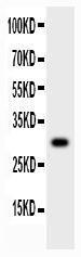 Anti-MMP-7 Polyclonal Antibody