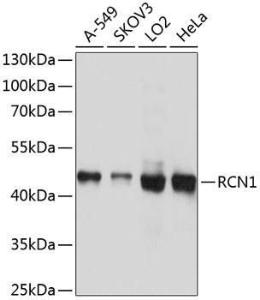 Western blot analysis of extracts of various cell lines, using Anti-RCN1 / RCN Antibody (A306458) at 1:1,000 dilution. The secondary antibody was Goat Anti-Rabbit IgG H&L Antibody (HRP) at 1:10,000 dilution.