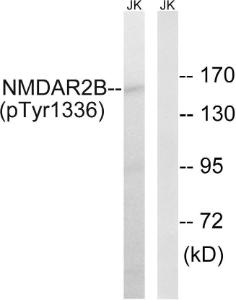 Western blot analysis of lysates from Jurkat cells treated with TNF 20ng/ml 30' using Anti-NMDAR2B (phospho Tyr1336) Antibody. The right hand lane represents a negative control, where the antibody is blocked by the immunising peptide.