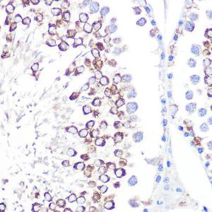 Immunohistochemistry analysis of paraffin-embedded rat testis using Anti-CD59 Antibody [ARC0896] (A305532) at a dilution of 1:100 (40x lens) Perform microwave antigen retrieval with 10 mM PBS buffer pH 72 before commencing with IHC staining protocol