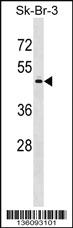 Anti-PAPD7 Rabbit Polyclonal Antibody