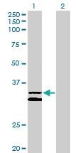 Anti-PCDH1 Rabbit Polyclonal Antibody