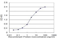 Anti-STAT5A Mouse Monoclonal Antibody [clone: 1B12]