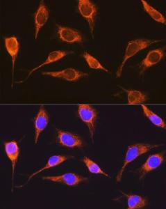 Immunofluorescence analysis of L929 cells using Anti-RCN1 / RCN Antibody (A306458) at a dilution of 1:100 (40x lens). DAPI was used to stain the cell nuclei (blue).