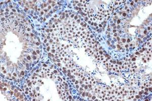 Immunohistochemistry analysis of paraffin-embedded mouse testis using Anti-Bub3 Antibody [ARC1318] (A307916) at a dilution of 1:100 (40x lens). Perform microwave antigen retrieval with 10 mM Tris/EDTA buffer pH 9.0 before commencing with IHC staining protocol.