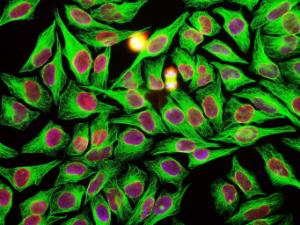 HeLa cells stained with Anti-Beta Tubulin Antibody (green), Anti-Lamin A/C Antibody (A85443/red) and DNA in blue Anti-Beta Tubulin Antibody reveals strong microtubular staining in the cytoplasm of HeLa cells, while the Anti-Lamin A/C Antibody localizes in the nuclear membrane