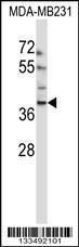 Anti-EMID1 Rabbit Polyclonal Antibody (APC (Allophycocyanin))