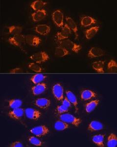 Immunofluorescence analysis of U-2 OS cells using Anti-RCN1 / RCN Antibody (A306458) at a dilution of 1:100 (40x lens). DAPI was used to stain the cell nuclei (blue).