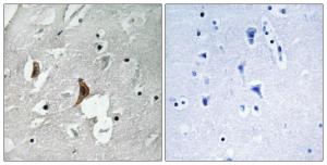 Immunohistochemical analysis of paraffin-embedded human brain using Anti-NMDAR2B (phospho Tyr1336) Antibody. The right hand panel represents a negative control, where the antibody was pre-incubated with the immunising peptide.