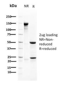 SDS-PAGE analysis of Anti-RAD51 Antibody [RAD51/2702] under non-reduced and reduced conditions; showing intact IgG and intact heavy and light chains, respectively. SDS-PAGE analysis confirms the integrity and purity of the antibody