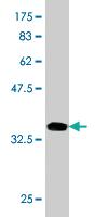 Anti-TRAPPC10 Mouse Monoclonal Antibody [clone: 5D5]