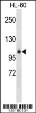 Anti-GPLD1 Rabbit Polyclonal Antibody