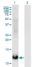 Anti-MSRB2 Mouse Monoclonal Antibody [clone: 3F12]