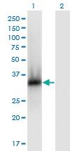 Anti-ZNF511 Mouse Monoclonal Antibody [clone: 3G1]