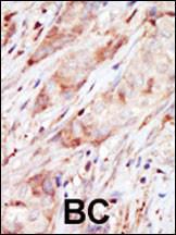 Anti-Hexokinase, Type IV Rabbit Polyclonal Antibody (AP (Alkaline Phosphatase))