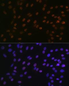 Immunofluorescence analysis of C6 cells using Anti-Bub3 Antibody [ARC1318] (A307916) at a dilution of 1:100 (40x lens). DAPI was used to stain the cell nuclei (blue).