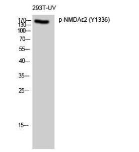 Western blot analysis of 293T UV cells using Anti-NMDAR2B (phospho Tyr1336) Antibody