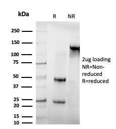 SDS-PAGE analysis of Anti-IRF3 Antibody [PCRP-IRF3-1E11] under non-reduced and reduced conditions; showing intact IgG and intact heavy and light chains, respectively. SDS-PAGE analysis confirms the integrity and purity of the antibody