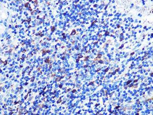 Anti-Stathmin 1 antibody