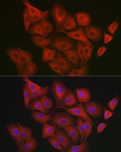 Anti-GART Rabbit Polyclonal Antibody