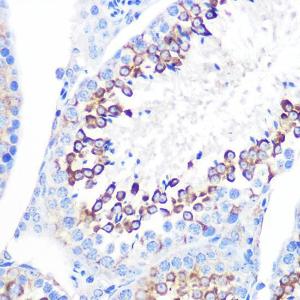 Immunohistochemistry analysis of paraffin-embedded mouse testis using Anti-CD59 Antibody [ARC0896] (A305532) at a dilution of 1:100 (40x lens) Perform microwave antigen retrieval with 10 mM PBS buffer pH 72 before commencing with IHC staining protocol