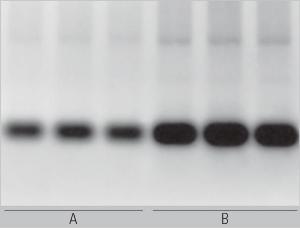 FERMR1471 - TRIS BUFFERED UTP 1X25 µMOL