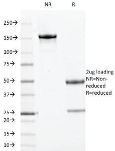 Anti-TOP1MT antibody