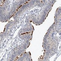 Anti-DNAH5 Rabbit Polyclonal Antibody