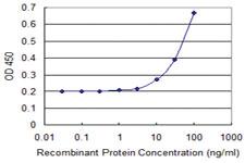 Anti-ZNF511 Mouse Monoclonal Antibody [clone: 3G1]