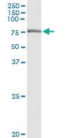 Anti-GBE1 Polyclonal Antibody Pair