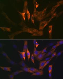 Anti-Stathmin 1 antibody