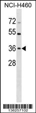 Anti-HUS1 Rabbit Polyclonal Antibody