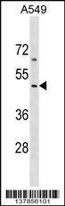 Anti-COL26A1 Rabbit Polyclonal Antibody (AP (Alkaline Phosphatase))