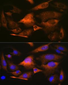 Anti-Stathmin 1 antibody