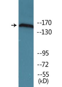 Antibody anti-NMDAR2B phospho TYR1336