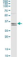 Anti-PCDH1 Mouse Monoclonal Antibody [clone: 2E8]