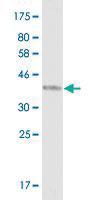 Anti-NBN Mouse Monoclonal Antibody [clone: 2C7]