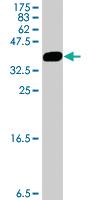 Anti-AP1M1 Mouse Polyclonal Antibody