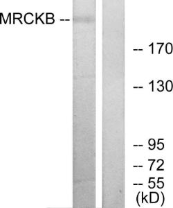 Western blot analysis of lysates from COLO cells using Anti-MRCKB Antibody. The right hand lane represents a negative control, where the antibody is blocked by the immunising peptide