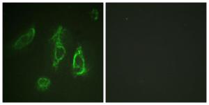 Immunofluorescence analysis of HeLa cells using Anti-Epo-R Antibody. The right hand panel represents a negative control, where the antibody was pre-incubated with the immunising peptide