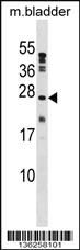 Anti-PTP4A1 Rabbit Polyclonal Antibody