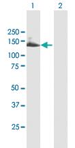 Anti-TTC18 Mouse Polyclonal Antibody